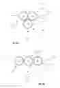 Fig. 04 - Aerostasis in pulmonary surgery