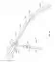 Fig. 15 - Aerostasis in pulmonary surgery