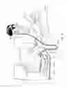 Fig. 03 - Vent arrangement for respiratory device