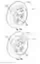 Fig. 17 - Vent arrangement for respiratory device