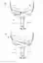 Fig. 30 - Vent arrangement for respiratory device