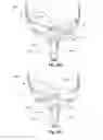 Fig. 31 - Vent arrangement for respiratory device