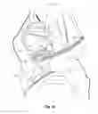 Fig. 32 - Vent arrangement for respiratory device