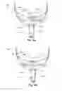 Fig. 33 - Vent arrangement for respiratory device