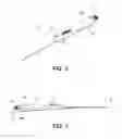 Fig. 03 - Transvascular access device and method