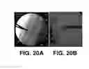 Fig. 19 - Transvascular access device and method