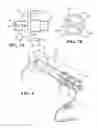 Fig. 05 - Modular handle assembly for a steerable catheter