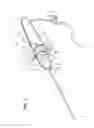 Fig. 02 - Modular handle assembly for a steerable catheter
