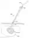 Fig. 01 - System and method for targeted delivery of therapeutic agents to tissue