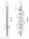 Fig. 04 - Device and method for compartmental vessel treatment