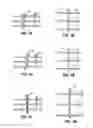 Fig. 05 - Device and method for compartmental vessel treatment