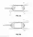 Fig. 05 - Methods and devices for eluting agents to a vessel