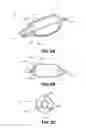 Fig. 10 - Methods and devices for eluting agents to a vessel