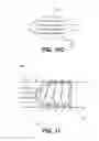 Fig. 13 - Methods and devices for eluting agents to a vessel