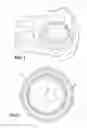 Fig. 02 - ATTACHABLE UTERINE DEVICE WITH INTEGRATED AND TIME RELEASE MEDICINAL ADMINISTERING COMPONENT AND INSERTION TOOL FOR IMPLANTING SUCH A DEVICE