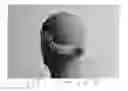 Fig. 03 - Cranial Position Determination System