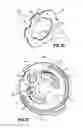 Fig. 16 - Surgical instrument having a bipolar end effector assembly and a deployable monopolar assembly