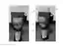Fig. 01 - Apparatus and method for prevention and mitigation of deep vein thrombosis