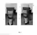 Fig. 02 - Apparatus and method for prevention and mitigation of deep vein thrombosis