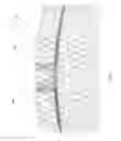 Fig. 23 - Microfabricated surface neurostimulation device and methods of making and using the same