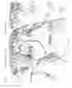 Fig. 34 - Microfabricated surface neurostimulation device and methods of making and using the same