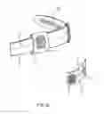 Fig. 03 - Stimulation brace