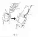 Fig. 09 - Stimulation brace