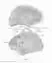 Fig. 08 - System and method for nested neurostimulation