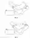 Fig. 09 - METHOD OF TREATING OR ALLEVIATING A PATIENT WITH INCONTINENCE