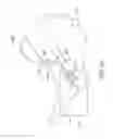 Fig. 18 - METHOD OF TREATING OR ALLEVIATING A PATIENT WITH INCONTINENCE