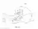 Fig. 19 - METHOD OF TREATING OR ALLEVIATING A PATIENT WITH INCONTINENCE