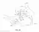Fig. 22 - METHOD OF TREATING OR ALLEVIATING A PATIENT WITH INCONTINENCE