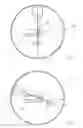 Fig. 03 - Portal imaging during radiotherapy