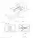 Fig. 08 - METHODS AND DEVICES TO MODULATE THE AUTONOMIC NERVOUS SYSTEM VIA THE CAROTID BODY OR CAROTID SINUS