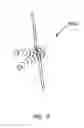 Fig. 17 - METHODS AND DEVICES TO MODULATE THE AUTONOMIC NERVOUS SYSTEM VIA THE CAROTID BODY OR CAROTID SINUS
