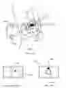 Fig. 20 - METHODS AND DEVICES TO MODULATE THE AUTONOMIC NERVOUS SYSTEM VIA THE CAROTID BODY OR CAROTID SINUS