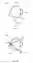 Fig. 25 - METHODS AND DEVICES TO MODULATE THE AUTONOMIC NERVOUS SYSTEM VIA THE CAROTID BODY OR CAROTID SINUS