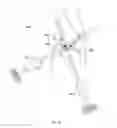 Fig. 26 - METHODS AND DEVICES TO MODULATE THE AUTONOMIC NERVOUS SYSTEM VIA THE CAROTID BODY OR CAROTID SINUS