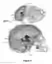 Fig. 05 - PLANNING SYSTEM FOR TARGETING TISSUE STRUCTURES WITH ULTRASOUND