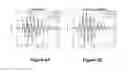 Fig. 06 - PLANNING SYSTEM FOR TARGETING TISSUE STRUCTURES WITH ULTRASOUND