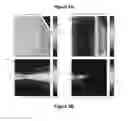 Fig. 09 - PLANNING SYSTEM FOR TARGETING TISSUE STRUCTURES WITH ULTRASOUND