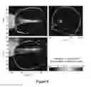 Fig. 10 - PLANNING SYSTEM FOR TARGETING TISSUE STRUCTURES WITH ULTRASOUND
