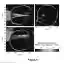 Fig. 12 - PLANNING SYSTEM FOR TARGETING TISSUE STRUCTURES WITH ULTRASOUND