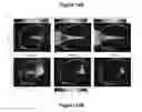 Fig. 13 - PLANNING SYSTEM FOR TARGETING TISSUE STRUCTURES WITH ULTRASOUND