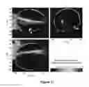Fig. 14 - PLANNING SYSTEM FOR TARGETING TISSUE STRUCTURES WITH ULTRASOUND
