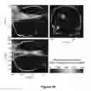 Fig. 15 - PLANNING SYSTEM FOR TARGETING TISSUE STRUCTURES WITH ULTRASOUND