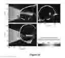 Fig. 16 - PLANNING SYSTEM FOR TARGETING TISSUE STRUCTURES WITH ULTRASOUND
