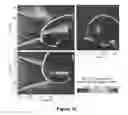 Fig. 17 - PLANNING SYSTEM FOR TARGETING TISSUE STRUCTURES WITH ULTRASOUND