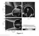 Fig. 18 - PLANNING SYSTEM FOR TARGETING TISSUE STRUCTURES WITH ULTRASOUND