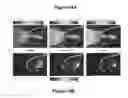 Fig. 19 - PLANNING SYSTEM FOR TARGETING TISSUE STRUCTURES WITH ULTRASOUND